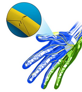  Peripheral Nerve Repair 