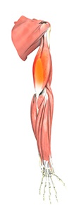 Triceps Tendonitis