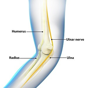  Ulnar Nerve Transposition 